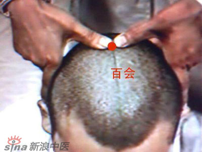 艾灸常用的保健穴有哪些？--百會