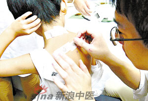 灸法的種類  你知道多少？