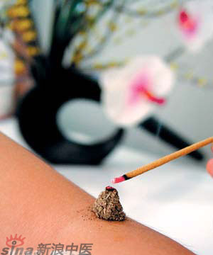 節(jié)氣灸” 冬至，你灸了嗎？