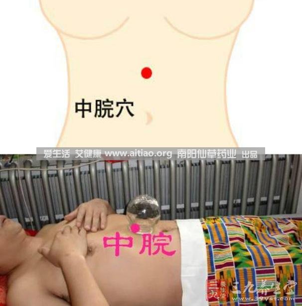 中脘穴位于腹部正中線，臍上4寸的位置上。每天艾灸10-15分鐘，能有效緩解胃部不適的癥狀，同時有助于祛濕。